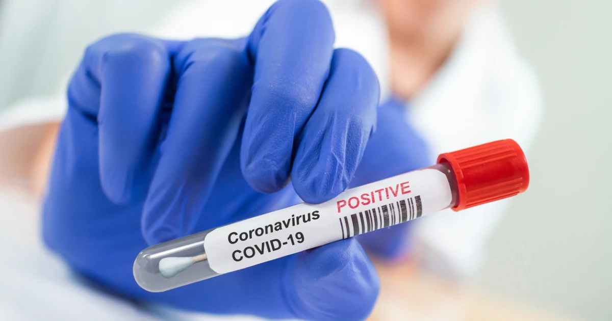 189 са новите случаи на коронавирус у нас, показват данните