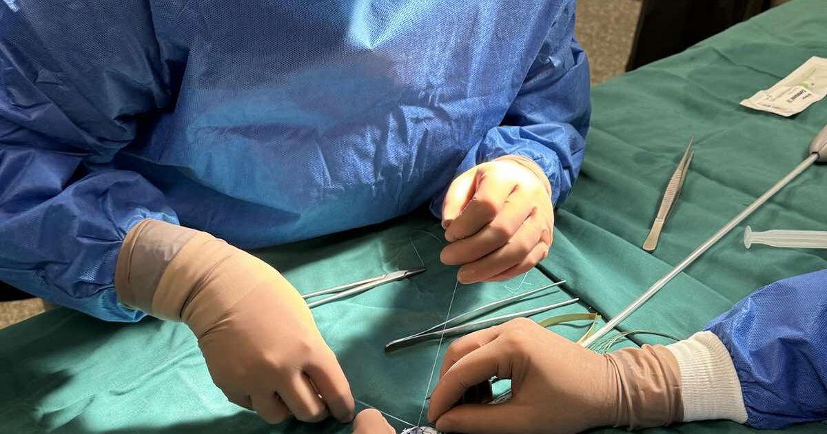 Съдови хирурзи спасиха живота на 81-годишна жена след 10-часова сложна
