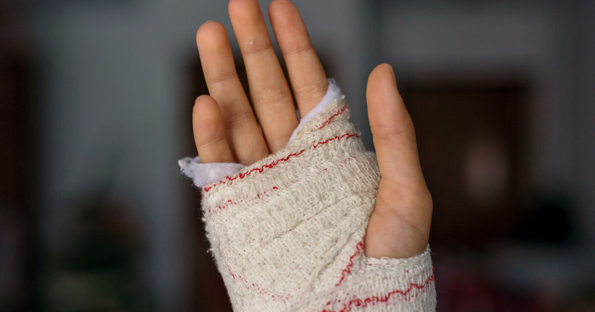 42-годишен мъж е срязал ръката си в ремонтна работилница в