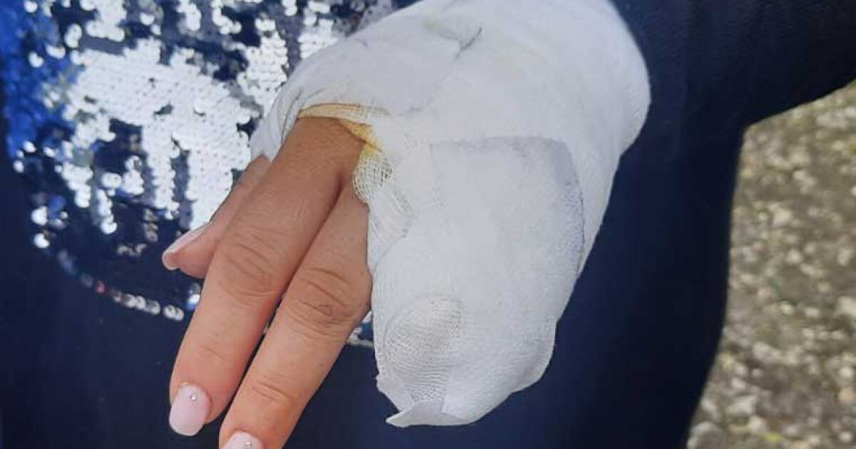 Бременна жена е с тежка травма на ръката след посещение