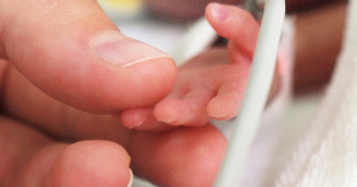 Медици спасиха бебе на 32 дни с вродена сърдечна малформация.