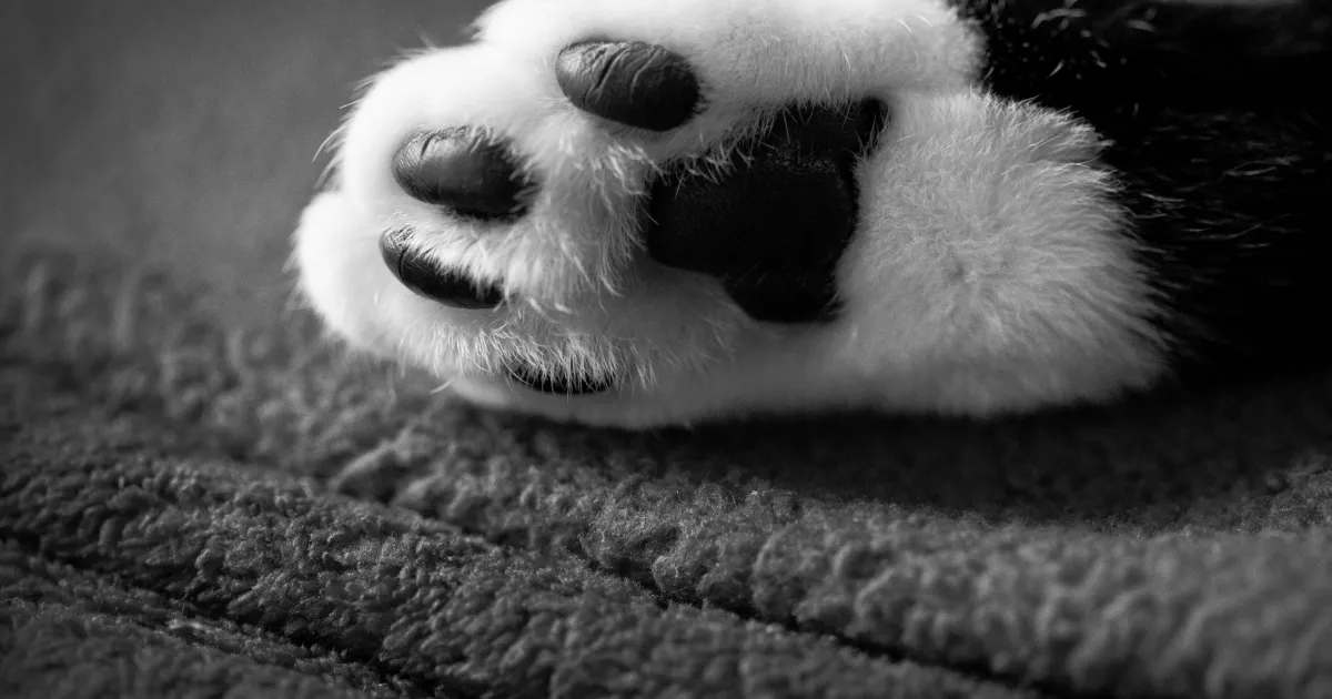 със счупен крак сама стигна до спешно отделение в Турция.