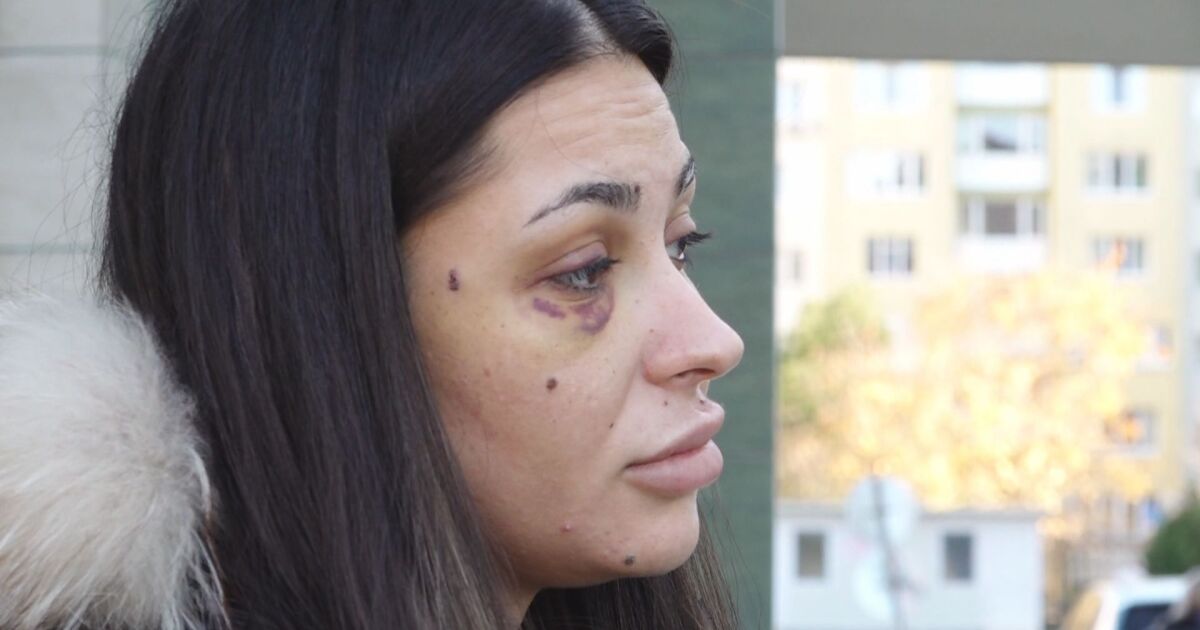 Нов случай на домашно насилие. 25-годишна жена е в болница