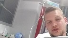 Скандал в Хърватия: Пребиха брутално футболист