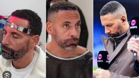 Футболна звезда си присади коса и брада в Истанбул (ВИДЕО)