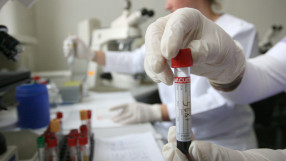 Бразилия отново има антидопингова лаборатория