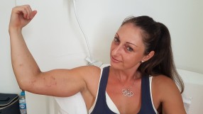 Даниела Тодорова се върна с два счупени крака от Рио