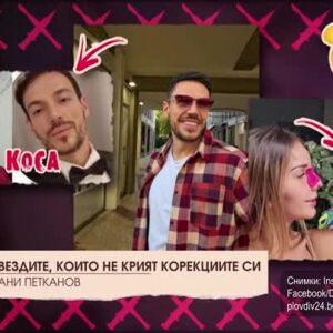 Снимка: Топ 10 звездите, които не крият корекциите си
