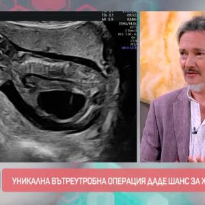 Снимка: Уникална вътреутробна операция даде шанс за живот на дете