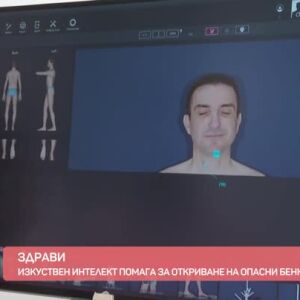Снимка: Здрави: Изкуствен интелект помага за откриване на опасни бенки