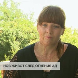 Снимка: Нов живот след огнен ад