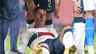 Кристиано Роналдо пострада тежко в Прага