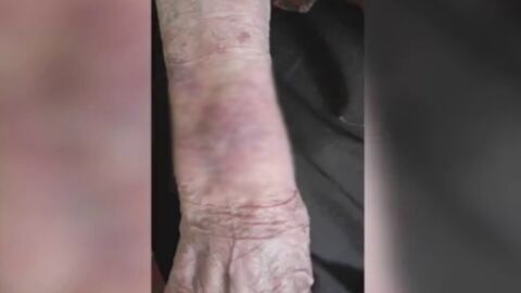 Снимка: След като бе изписана със синини от видинската болница: Какво е състоянието на 104-годишната жена?