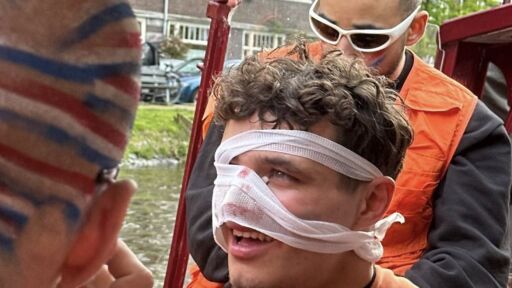 Пилот от Ф1 си наряза носа на парти в Амстердам (ВИДЕО)
