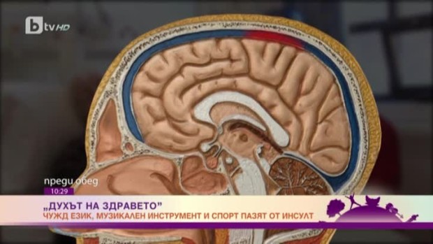 Снимка: Духът на здравето: Чужд език, музикален инструмент и спорт пазят от инсулт