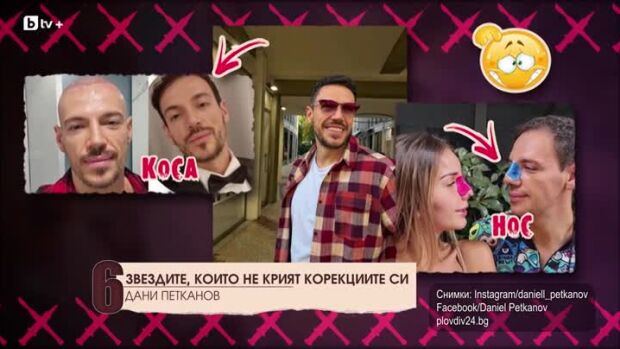 Снимка: Топ 10 звездите, които не крият корекциите си