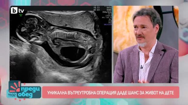 Снимка: Уникална вътреутробна операция даде шанс за живот на дете