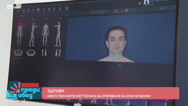 Снимка: Здрави: Изкуствен интелект помага за откриване на опасни бенки