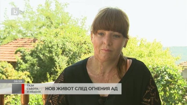 Снимка: Нов живот след огнен ад