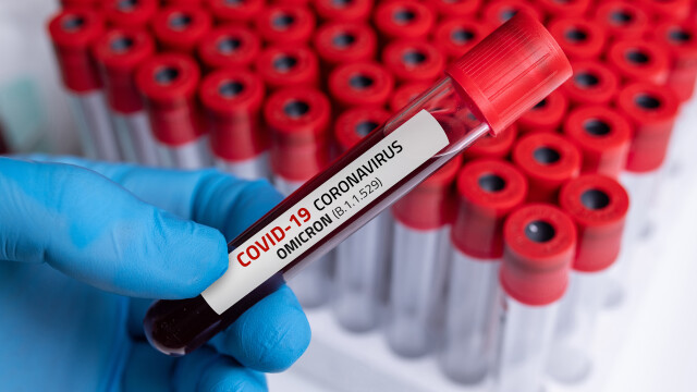 968 са новите случаи на коронавирус у нас за последното