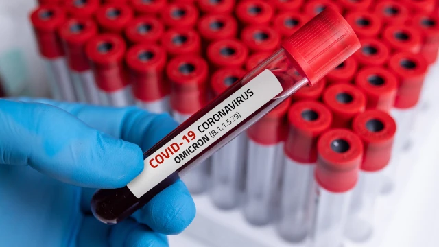 Новите случаи на коронавирус у нас са 704 за последното