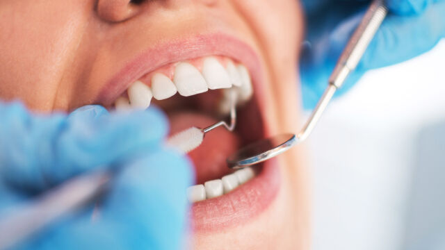 Жена от Минесота съди зъболекаря си твърдейки че я е