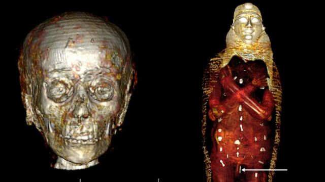 Kомпютърно томографско сканиране показа че младеж починал преди 2300 години