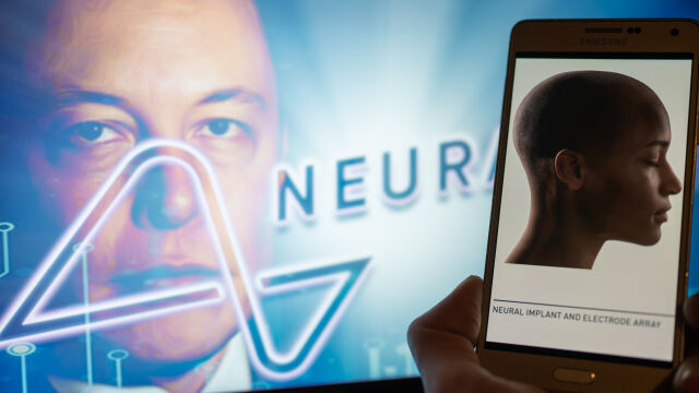 Илон Мъск търси втори човек, на когото Neuralink да постави мозъчен имплант 