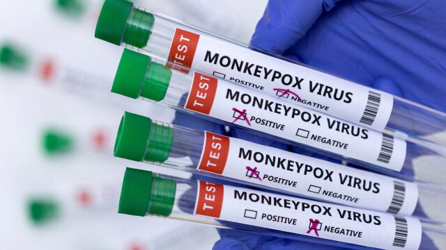 Третият пациент при който беше потвърдена зараза с маймунска вариола