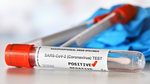 362 нови случая на коронавирус при направени 4063 теста Положителните проби