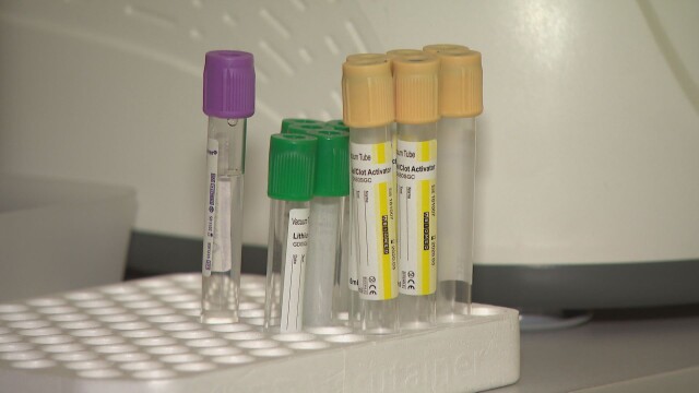 Още две проби, съмнителни за новия остър хепатит, който засяга
