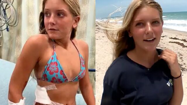 13 годишно момиче оцеля след нападение от акула на плаж на