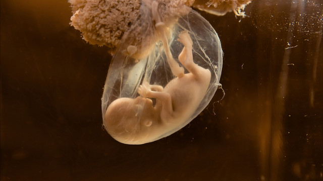 Учените отгледаха същество което много прилича на ранен човешки ембрион