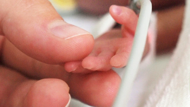 Медици спасиха бебе на 32 дни с вродена сърдечна малформация
