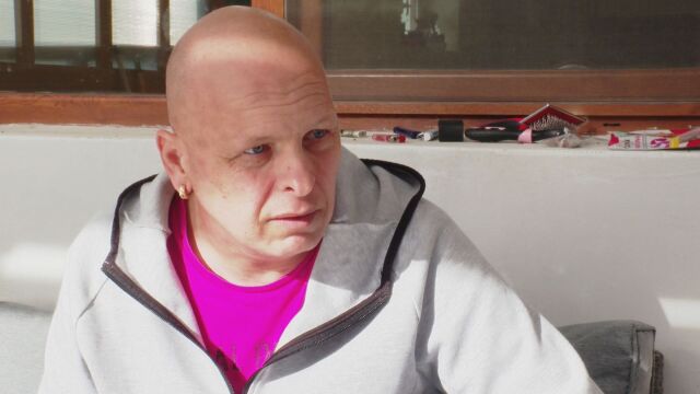 42 годишен мъж от Варна страда от рак на костите От