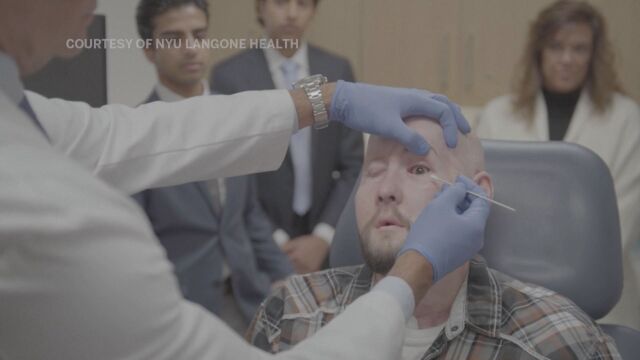 Огромна крачка напред: Хирурзи обявявиха първата в света трансплантация на око (ВИДЕО)