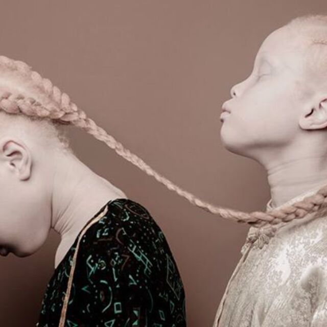 Лара и Мара – близначките-албиноси, взривили модния свят
