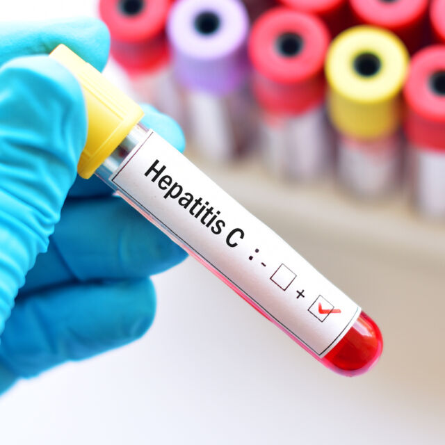 НЦЗПБ: Няма остър хепатит у нас 