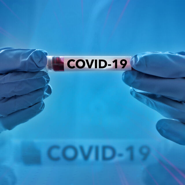93 са новите случаи на COVID-19 у нас