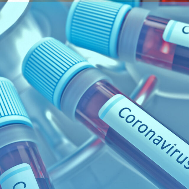 Българска ваксина срещу COVID-19 се разработва в Института по микробилогия на БАН