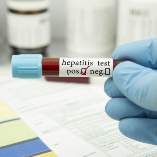 СЗО проверява случаите на мистериозен хепатит при децата в 12 страни