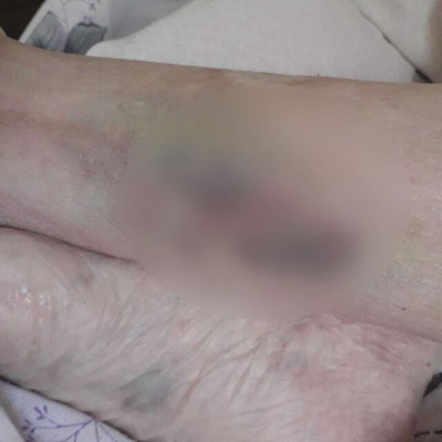  Гладна, жадна и вързана: Как лекуваха 104-годишна жена в болница? 