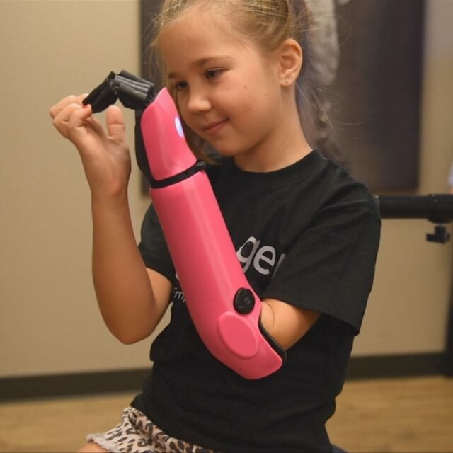 8-годишно момиче използва бионичната си ръка за първи път (ВИДЕО)