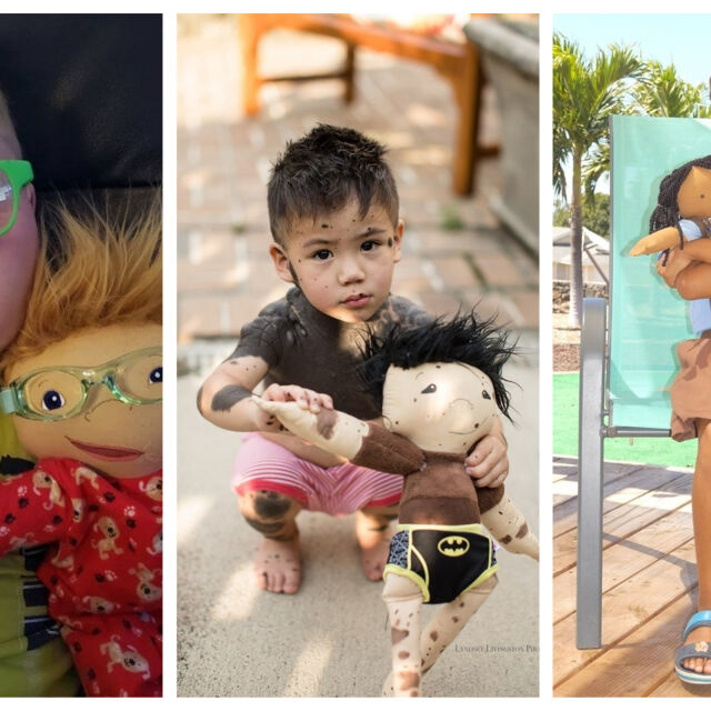 Кукли с увреждания помагат на деца да приемат себе си