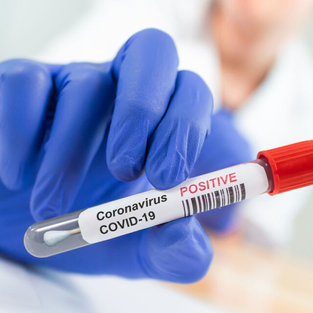 Близо 1600 нови случая на COVID-19 у нас за денонощие