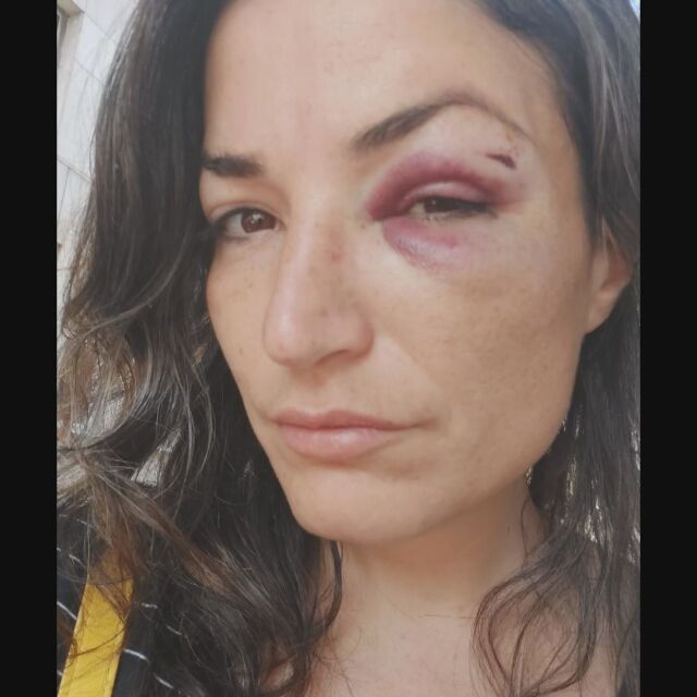 Жена бе нападната от мъж на улицата: Тя разказа, че просто е минавала покрай него 