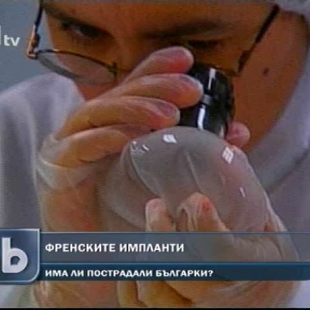 1500 са българките с дефектни гръдни импланти