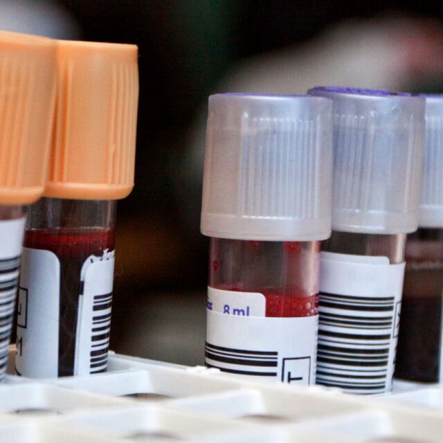 Проверка в Кръвния център откри недостиг на тестове за изследване на кръвта