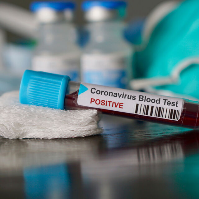 Първа жертва на коронавируса в Европа