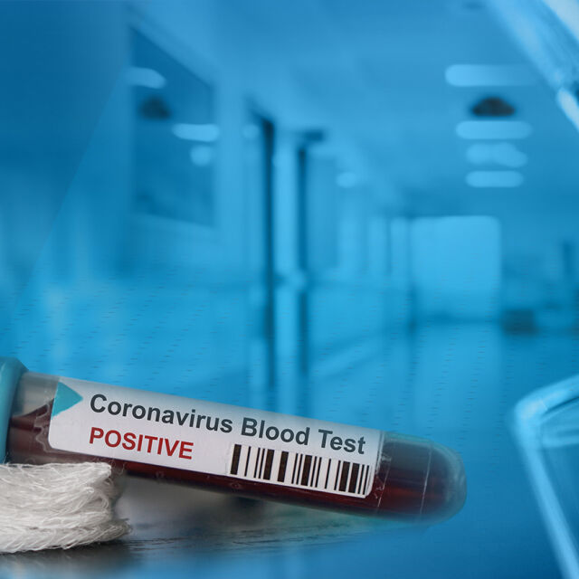 Тест за коронавирус – само при симптоми и по лекарско предписание